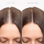 Recarga Fibras Capilares ProHair 25g - Imagen 7
